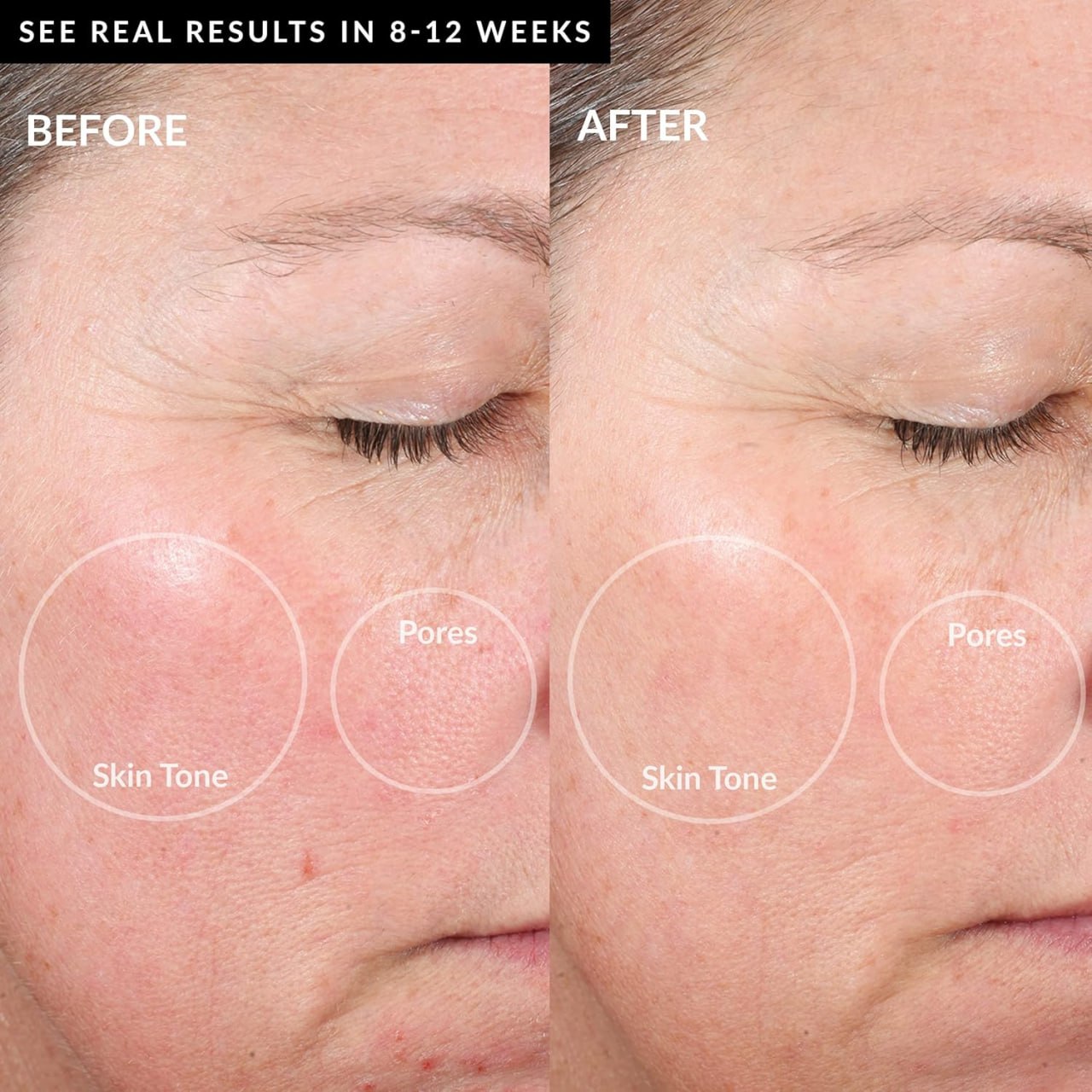 PMD Personal Microderm Elite Pro Image 4